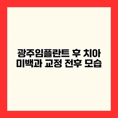 광주임플란트 후 치아 미백과 교정 전후 모습