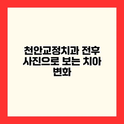 천안교정치과 전후 사진으로 보는 치아 변화
