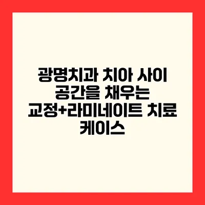광명치과 치아 사이 공간을 채우는 교정+라미네이트 치료 케이스