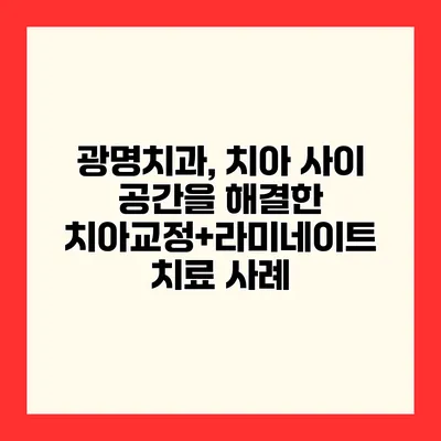 광명치과, 치아 사이 공간을 해결한 치아교정+라미네이트 치료 사례