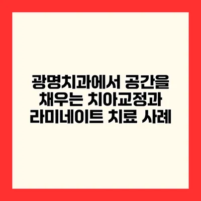 광명치과에서 공간을 채우는 치아교정과 라미네이트 치료 사례