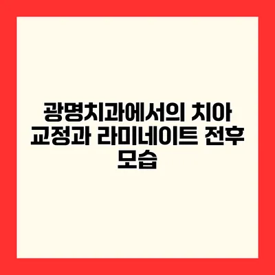 광명치과에서의 치아 교정과 라미네이트 전후 모습