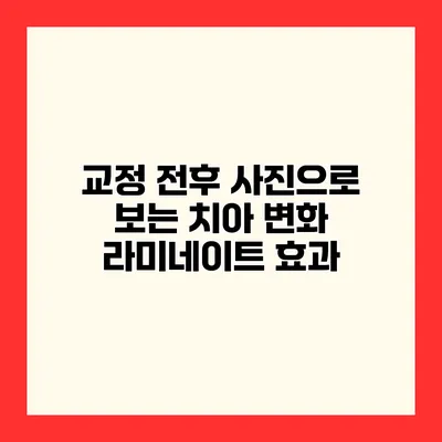 교정 전후 사진으로 보는 치아 변화 라미네이트 효과