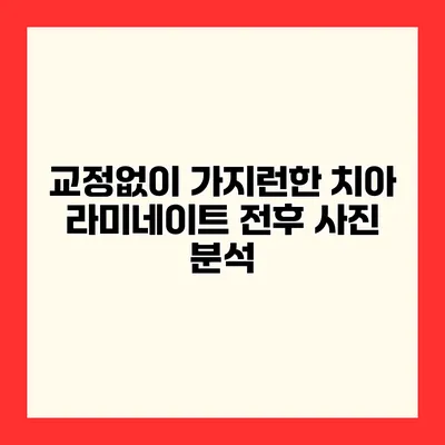 교정없이 가지런한 치아 라미네이트 전후 사진 분석