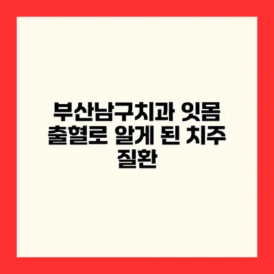 부산남구치과 잇몸 출혈로 알게 된 치주 질환
