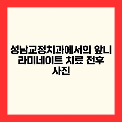 성남교정치과에서의 앞니 라미네이트 치료 전후 사진