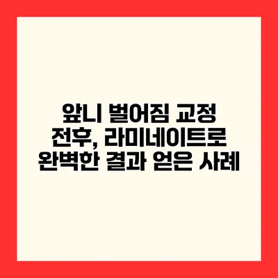 앞니 벌어짐 교정 전후, 라미네이트로 완벽한 결과 얻은 사례