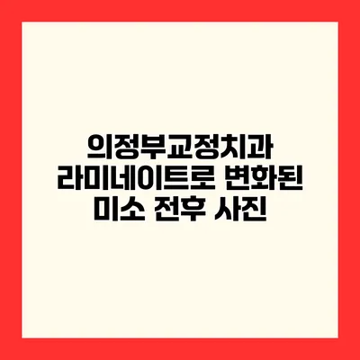 의정부교정치과 라미네이트로 변화된 미소 전후 사진