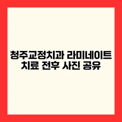 청주교정치과 라미네이트 치료 전후 사진 공유